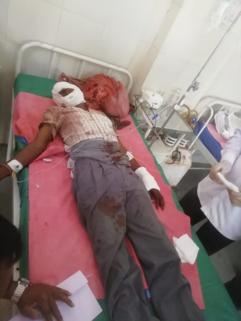 अस्वलाच्या हल्ल्यात इसम  गंभीर जखमी