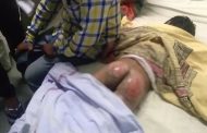 मातंग समाजाच्या ८ वर्षीच्या चिमुकल्या मुलाला गरम स्टाईलवर बसवून बेदम मारहाण; मंदिरात चोरीच्या संशयावरून मारहाण