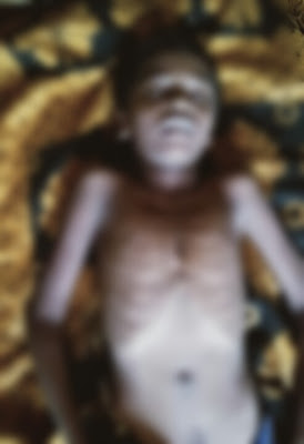 विज पडल्याने बाळापूर खुर्द येथील १२ वर्षीय मुलाचा मृत्यू