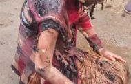 भरचौकात शिक्षिकेला जाळलं, घटनेविरोधात विद्यार्थिनींचा आक्रोश