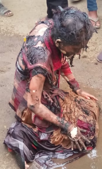 भरचौकात शिक्षिकेला जाळलं, घटनेविरोधात विद्यार्थिनींचा आक्रोश